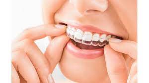 Invisalign, Clear Braces in Federal Way, WA: Orthodontist Explains Teeth Straightening for Adults