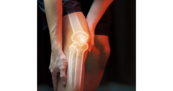 The UK’s Stem Cell Revolution: Fast, Natural Relief for Joint Pain
